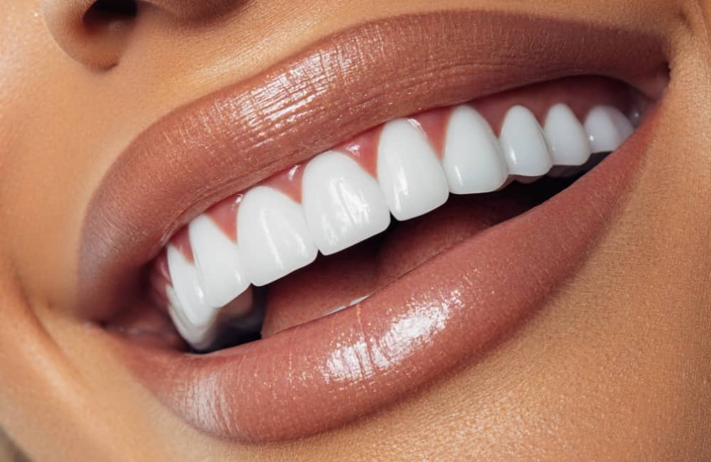Top tips for a whiter smile