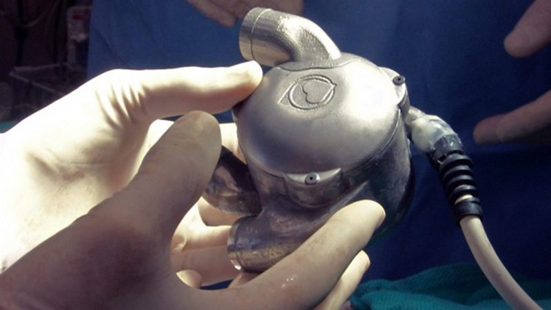 Bionic heart invention provides hope for heart disease