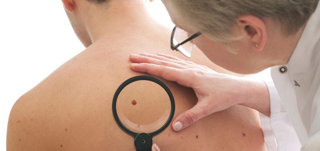 New technology to detect melanoma