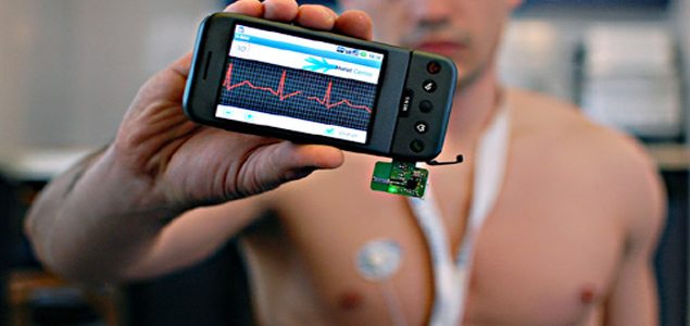 iPhone case & app helps detect stroke-causing heart rhythm