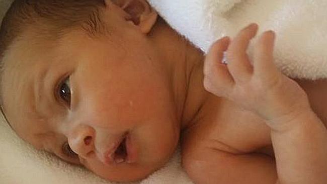 Newborn dies after contracted cold sore virus