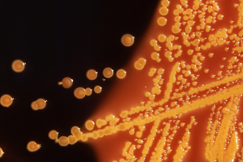 FILE PHOTO: Colonies of E. coli bacteria grown on a Hektoen enteric (HE) agar plate are seen in a microscopic image courtesy of the U.S. Centers for Disease Control (CDC).  File Photo - RC12C72AE570