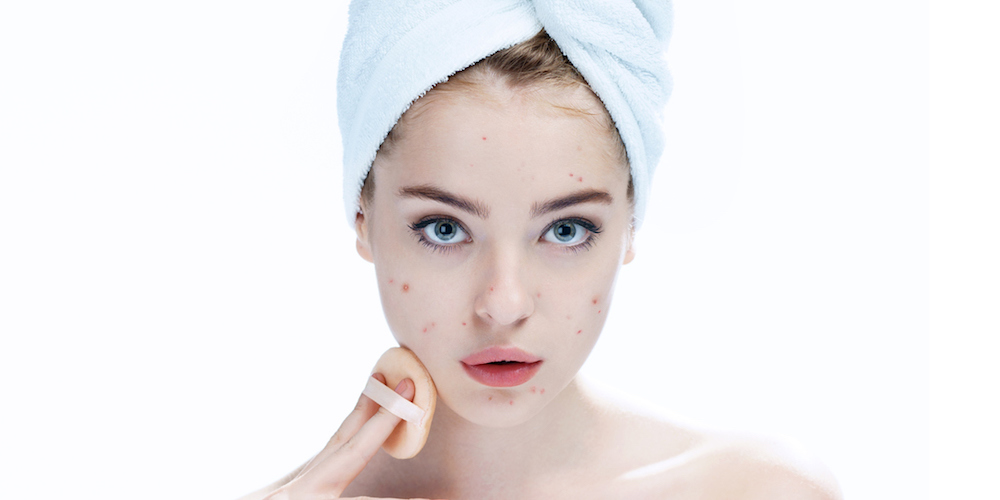 Ugly problem skin girl. Woman skin care concept / photos of european girl on white background