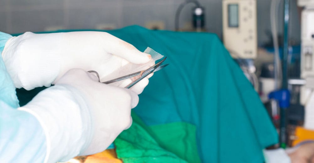 Report on surgical mesh injuries received