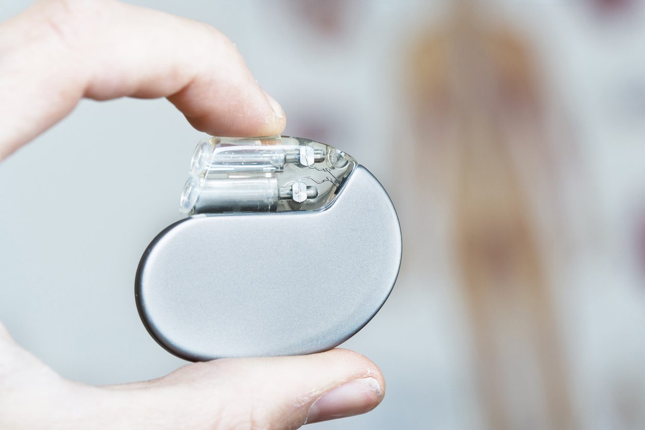 A cardiac pacemaker. XXL size image.