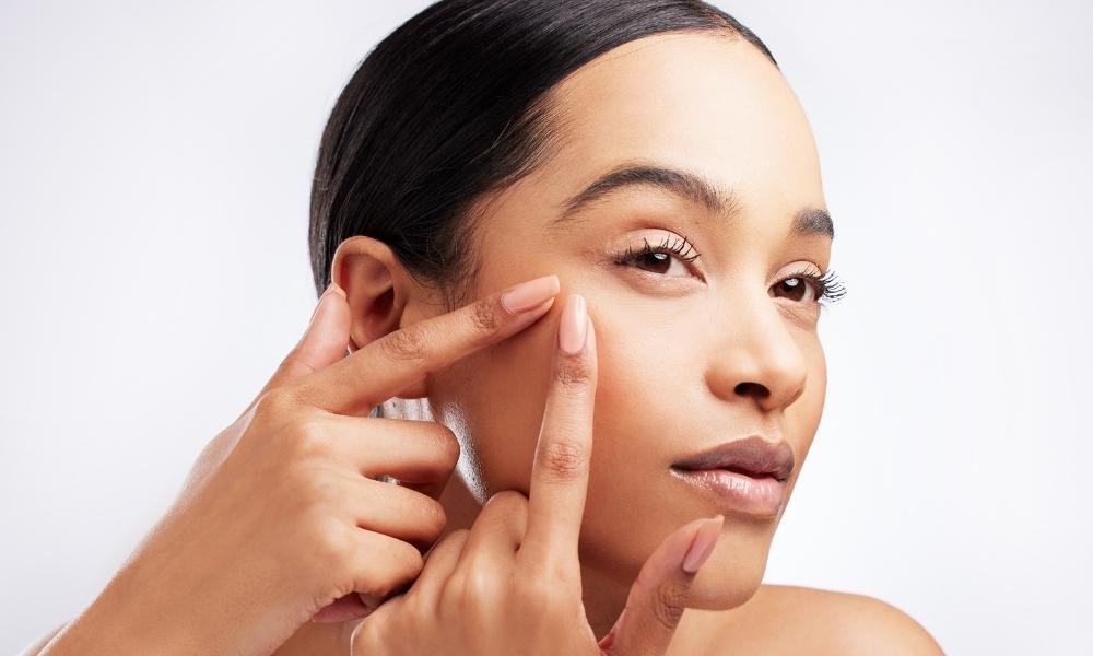 Five of the best pimple patches and how to use them