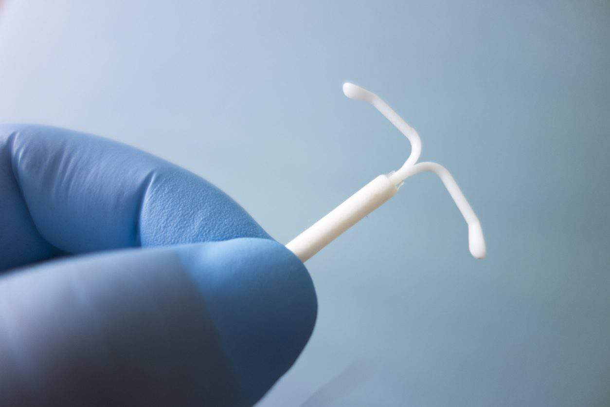 Do IUDs Cause Breast Cancer? Here’s What the Evidence Says
