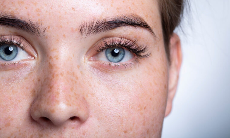 What is Ferritin face