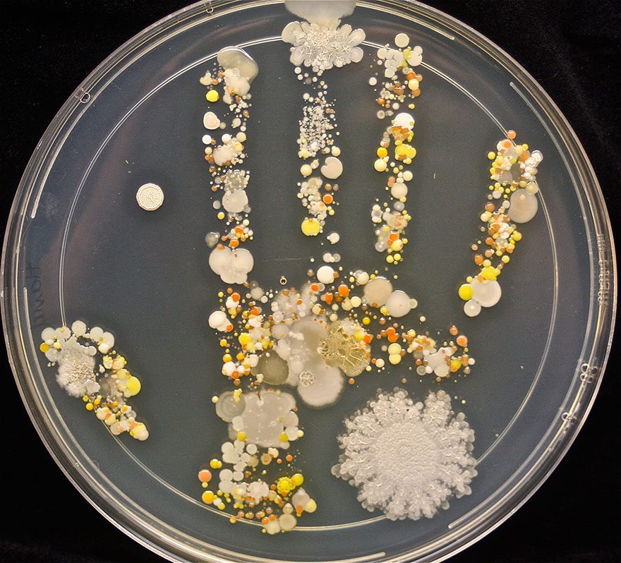 Striking photo shows all the bacteria on an 8-year-old’s hand after playing outside