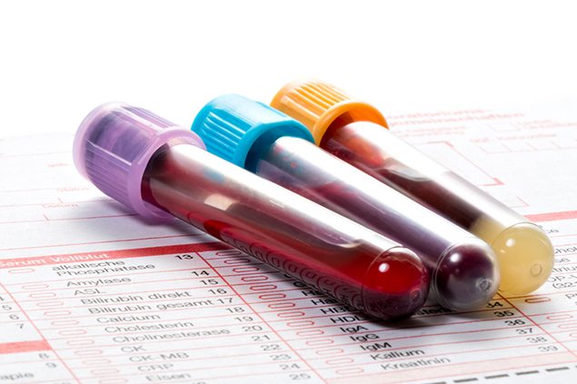 Blood test could identify correct depression medication