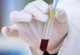 blood-test-1