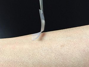 Smart Insulin Patch could liberate diabetics from  painful needles