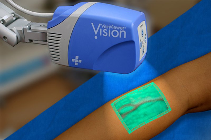 Hate needles? New technology makes it easier for doctors to find veins